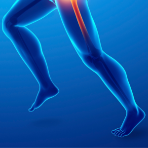 lower leg pain illustration of male