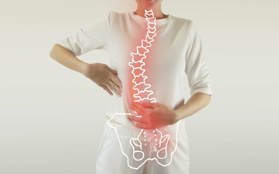 physiotherapy for scoliosis