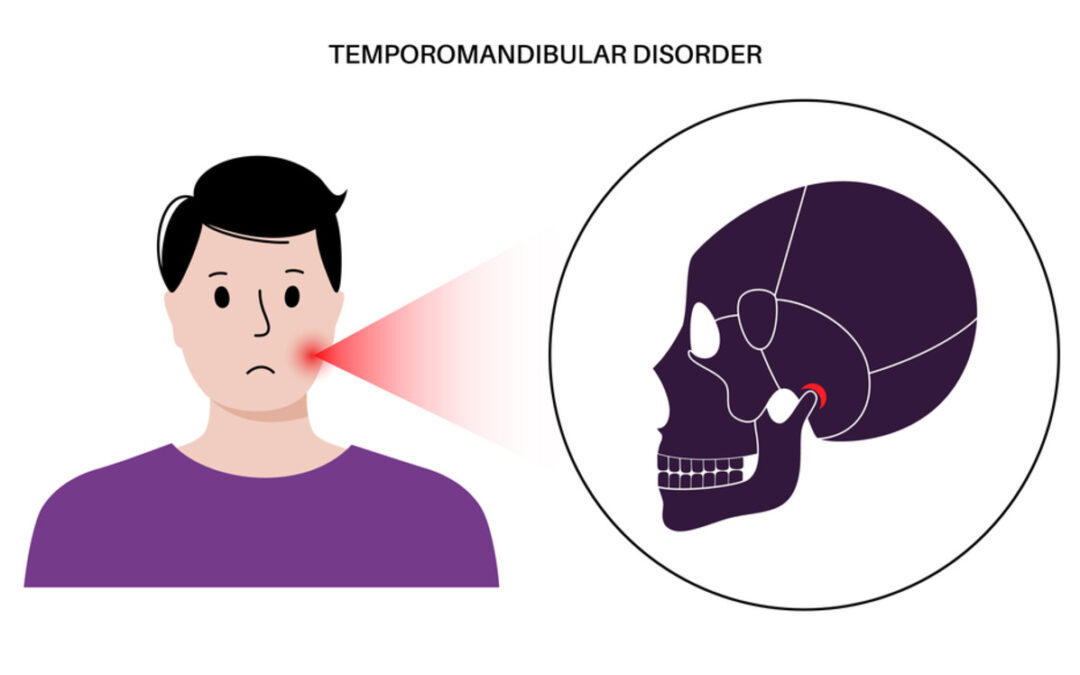 Alleviate Jaw Pain and Improve Function: Physiotherapy for TMJ