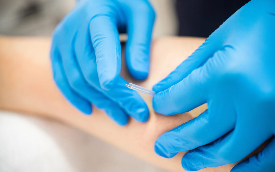 Beyond the Myths: What Makes Dry Needling a Safe Option for Pain Relief