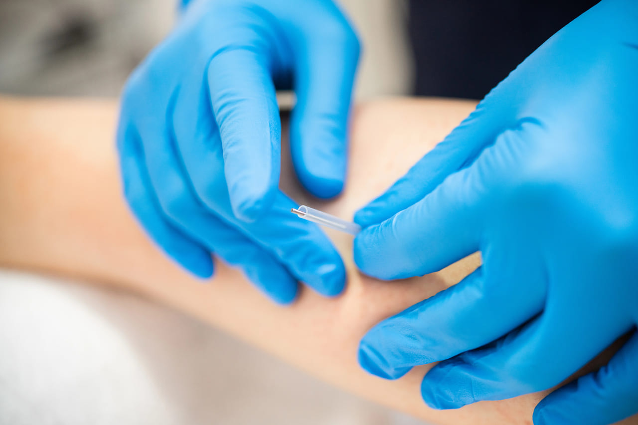 is dry needling safe sherwood park